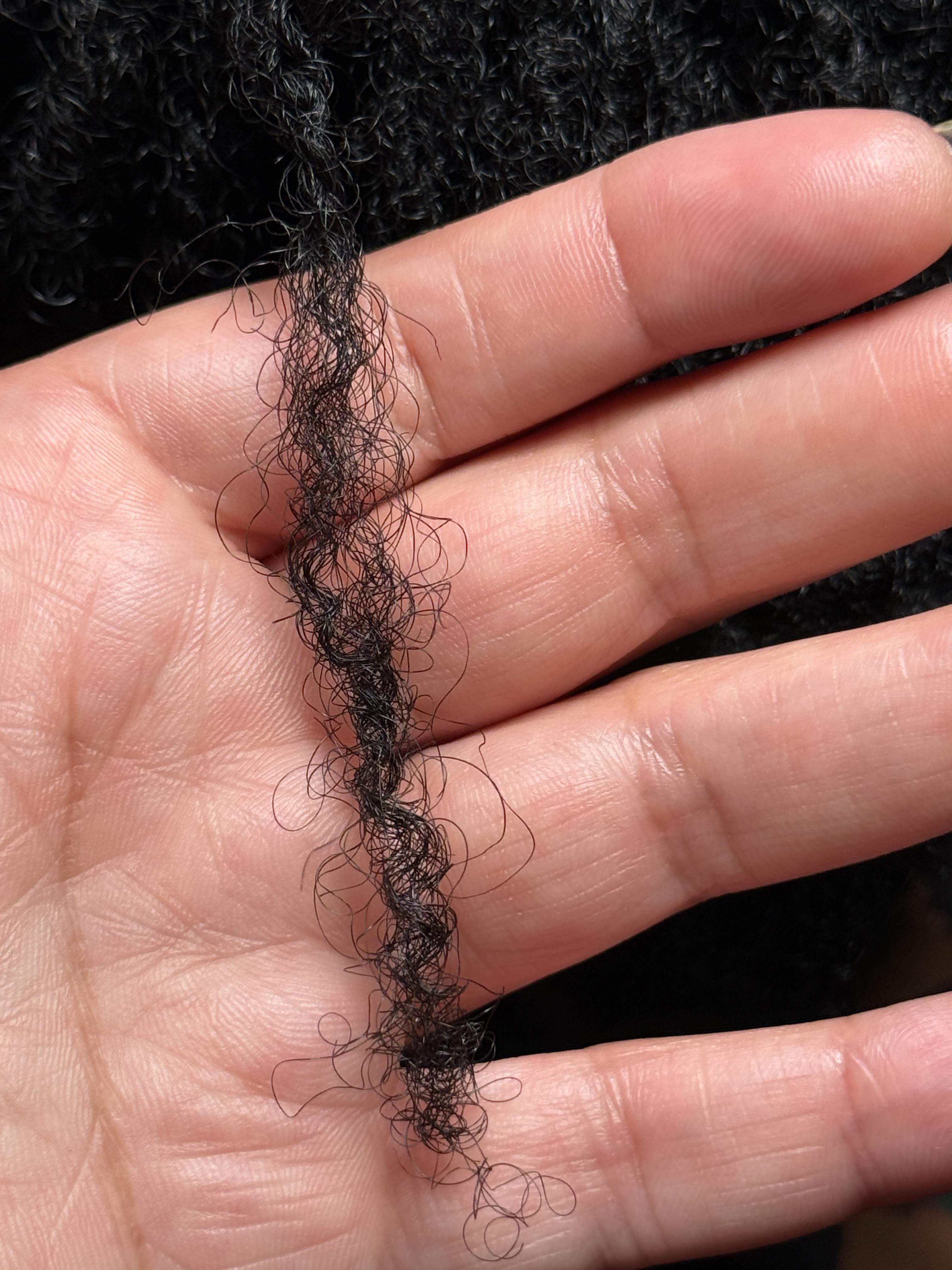 Loc showing slippage and loosening before repair